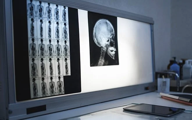 医療の画像診断サポート